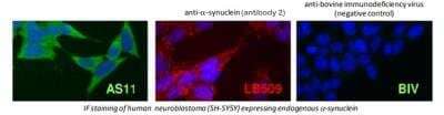 Immunocytochemistry/Immunofluorescence: alpha-Synuclein Antibody (AS11) [DDX0910P-100] - IF staining of human neuroblastoma (SH-SY5Y) expressing endogenous  alpha-synuclein
