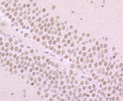 Immunohistochemistry-Paraffin: alpha-Synuclein Antibody (JB42-33) [NBP2-80442] - Analysis in mouse brain tissue using alpha-Synuclein antibody. Counter stained with hematoxylin.