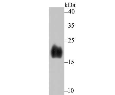Western Blot: alpha-Synuclein Antibody (JB42-33) [NBP2-80442] - Analysis of alpha-Synuclein on human fetal brain tissue lysate using anti-alpha-Synuclein antibody at 1/500 dilution.