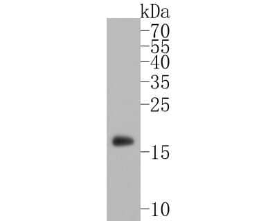 Western Blot: alpha-Synuclein Antibody (JB42-33) [NBP2-80442] - Western blot analysis of alpha-Synuclein on human brain tissue lysates. Proteins were transferred to a PVDF membrane and blocked with 5% BSA in PBS for 1 hour at room temperature. The primary antibody (1/500) was used in 5% BSA at room temperature for 2 hours. Goat Anti-Rabbit IgG - HRP Secondary Antibody (HA1001) at 1:5,000 dilution was used for 1 hour at room temperature.
