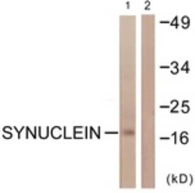Western Blot: alpha-Synuclein Antibody [NBP1-61418] - Analysis of extracts from HuvEc cells, using alpha-Synuclein  Antibody. The lane on the right is treated with the synthesized peptide.