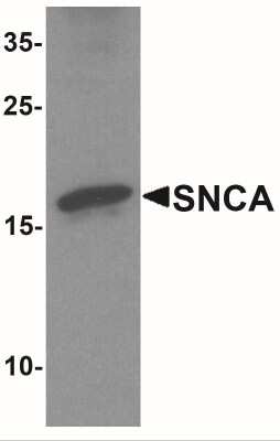 Western Blot: alpha-Synuclein Antibody [NBP2-41288] - Western blot analysis of SNCA in mouse cerebellum tissue lysate with SNCA antibody at 1 ug/ml.