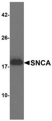 Western Blot: alpha-Synuclein Antibody [NBP2-41288] - Analysis of 1 ng of recombinant human SNCA with SNCA antibody at 1 ug/ml.