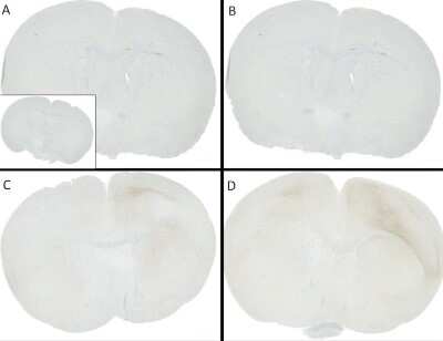 Immunohistochemistry: alpha-Synuclein [p Ser 129] Antibody (J18) [NBP3-18266] - C57/BL6 mice were injected with sonicated recombinant mouse alpha synuclein monomers or fibrils at 8 weeks of age. Mice were unilaterally injected in the dorsal striatum (bregma AP + 0.2 mm, L +/1 2.0 mm, V - 3.0 mm) and sacrificed 30 days post-injection.  (A) 1.25 uL  mouse alpha synuclein monomers. (B) 2.5 uL mouse alpha synuclein monomers. (C) 2.5 ug alpha synuclein PFFs. (C) 5 ug alpha synuclein PFFs   Inset: PBS (negative control). Primary antibody: Anti-alpha-Synuclein (NBP3-18266) at 1:10 000. Secondary antibody: anti-rabbit HRP. Mice injected with PFF displayed alpha synuclein staining in the striatum and cortex and contralateral to the injection site.