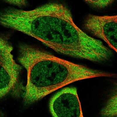 Immunocytochemistry/ Immunofluorescence alpha-Taxilin Antibody