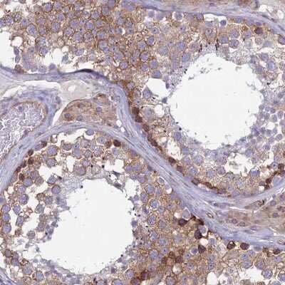 Immunohistochemistry-Paraffin alpha-Taxilin Antibody