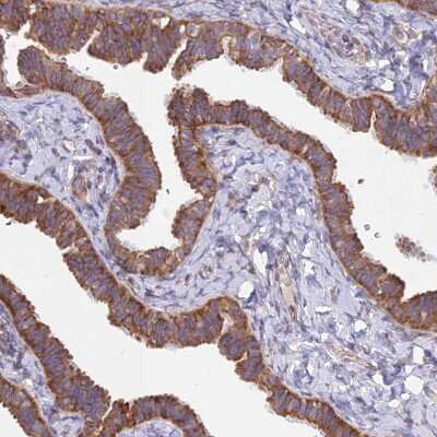 Immunohistochemistry-Paraffin alpha-Taxilin Antibody