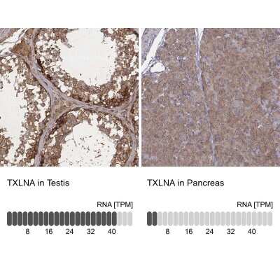 Immunohistochemistry-Paraffin: alpha-Taxilin Antibody [NBP2-56295] - Staining in human testis and pancreas tissues using anti-TXLNA antibody. Corresponding TXLNA RNA-seq data are presented for the same tissues.