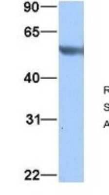 Western Blot: alpha Tubulin 3c Antibody [NBP1-53026] - Hela, Antibody Dilution: 1.0 ug/ml TUBA3C is supported by BioGPS gene expression data to be expressed in HeLa.