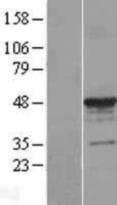 Western Blot alpha Tubulin 3c Overexpression Lysate