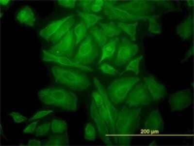 Immunocytochemistry/Immunofluorescence: alpha Tubulin 4a Antibody (2E11) [H00007277-M01] - Analysis of monoclonal antibody to TUBA1 on HeLa cell. Antibody concentration 10 ug/ml.