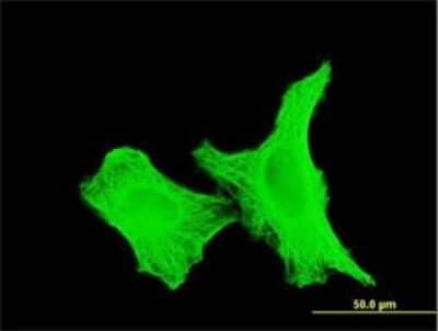 Immunocytochemistry/Immunofluorescence: alpha Tubulin 4a Antibody (2E9) [H00007277-M06] - Analysis of monoclonal antibody to TUBA4A on HeLa cell. Antibody concentration 10 ug/ml