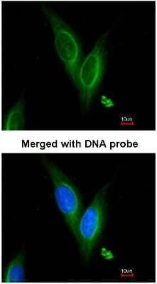 Immunocytochemistry/Immunofluorescence: alpha Tubulin 4a Antibody [NBP1-31392] - Analysis of HeLa, using NBP1-31392 at 1:200 dilution.