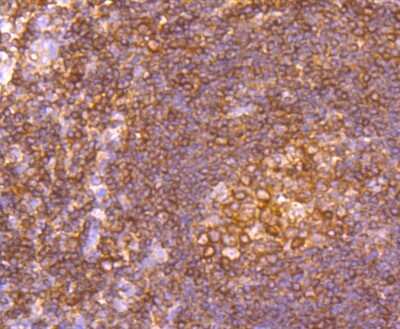 Immunohistochemistry-Paraffin: alpha Tubulin 4a Antibody (JM73-24) [NBP2-67148] - Analysis of paraffin-embedded human tonsil tissue using anti-alpha Tubulin 4A antibody. Counter stained with hematoxylin.