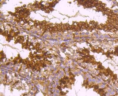 Immunohistochemistry-Paraffin: alpha Tubulin 4a Antibody (JM73-24) [NBP2-67148] - Analysis of paraffin-embedded mouse testes tissue using anti-alpha Tubulin 4A antibody. Counter stained with hematoxylin.