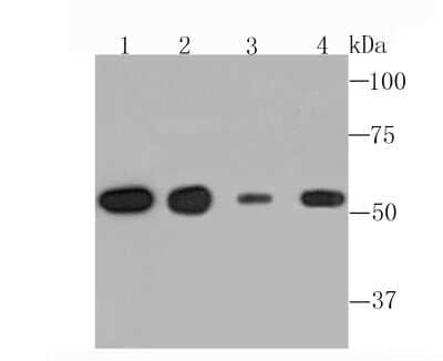 Western Blot: alpha Tubulin 4a Antibody (JM73-24) [NBP2-67148] - Analysis of alpha Tubulin 4A on different lysates using anti-alpha Tubulin 4A antibody at 1/1,000 dilution. Positive control: Lane1: A431 Lane2: Rat brain tissue Lane3: NIH-3T3 Lane4: PC-12