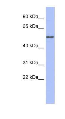 Western Blot: alpha Tubulin 4a Antibody [NBP1-53162] - Human Small Intestine, concentration 0.2-1 ug/ml.