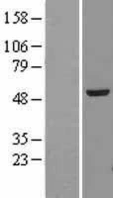 Western Blot alpha Tubulin 4a Overexpression Lysate