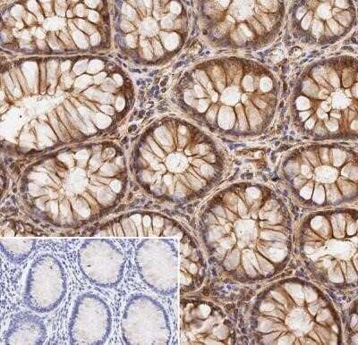 Immunohistochemistry: alpha Tubulin Antibody (DM1A) - Azide and BSA Free [NBP2-80570] - Analysis of colon tissue. Sections were formalin fixed and embedded with paraffin. Sodium citrate heat mediated antigen retrieval for 20 min. Incubated with primary antibody for 15 min at a 5 ug/ml concentration. Corner image is staining with secondary on