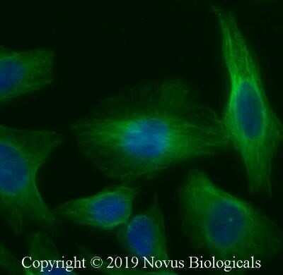 Immunocytochemistry/Immunofluorescence: alpha Tubulin Antibody (YOL1/34) - Azide and BSA Free [NBP2-80569] - HeLa cells were fixed for 10 minutes using 10% formalin and then permeabilized for 5 minutes using 1X PBS + 0.05% Triton-X100. The cells were incubated with anti-Tubulin Antibody [YOL1/34] at 5 ug/ml overnight at 4C and detected with an anti-rat Dylight 488 (Green) at a 1:500 dilution. Nuclei were counterstained with DAPI (Blue). Cells were imaged using a 40X objective. Image from the standard format of this antibody.