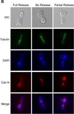 Immunocytochemistry/Immunofluorescence: alpha Tubulin Antibody (YOL1/34) - Azide and BSA Free [NBP2-80569] - Representative images from Cdc14 release assay. Cells are assayed for spindle morphology & Cdc14 release phenotype by indirect immunofluorescence with anti-tubulin or anti-HA, which recognizes the HA-tagged version of Cdc14 in all strains. Cells are visualized by nuclear staining with DAPI & by differential interference contrast (DIC) optics for comparison. No release refers to dense nucleolar staining of Cdc14-HA, full release refers to cells with uniform Cdc14-HA localization throughout the nucleus, while partial release refers to cells with both nuclear & residual nucleolar staining. Image collected & cropped by CiteAb from the following publication (//dx.plos.org/10.1371/journal.pgen.1000588), licensed under a CC-BY license. Image from the st&ard format of this antibody.