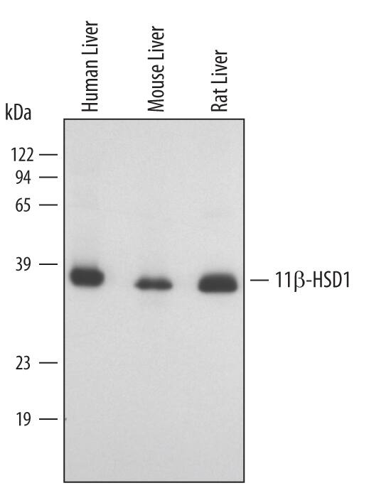 Western blot shows lysates of human, mouse and rat liver tissue. PVDF membrane was probed with 0.5 µg/mL of Human/Mouse/Rat 11 beta -HSD1 Antigen Affinity-purified Polyclonal Antibody (Catalog # AF3397) followed by HRP-conjugated Anti-Goat IgG Secondary Antibody (Catalog # HAF109). A specific band was detected for 11 beta -HSD1 at approximately 36 kDa (as indicated). This experiment was conducted using Immunoblot Buffer Group 2.