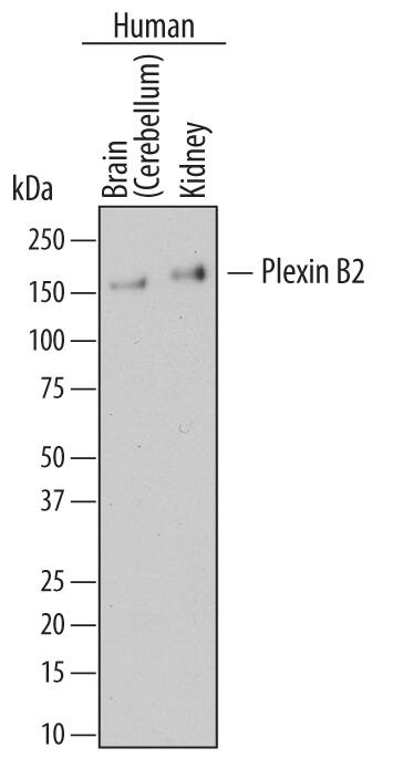 Western blot shows lysates of human brain (cerebellum) tissue and human kidney tissue. PVDF membrane was probed with 2 µg/mL of Mouse Anti-Human Plexin B2 Monoclonal Antibody (Catalog # MAB53292) followed by HRP-conjugated Anti-Mouse IgG Secondary Antibody (Catalog # HAF007). A specific band was detected for Plexin B2 at approximately 170 kDa (as indicated). This experiment was conducted under reducing conditions and using Immunoblot Buffer Group 1.