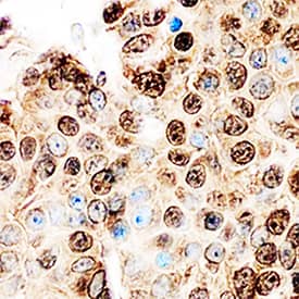 Immunohistochemistry Cyclin E2 Antibody (718916) [Unconjugated]