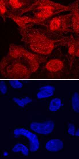 TAZ/WWTR1 was detected in immersion fixed BG01V human embryonic stem cells using Mouse Anti-Human TAZ/WWTR1 Monoclonal Antibody (Catalog # MAB7210) at 10 µg/mL for 3 hours at room temperature. Cells were stained using the NorthernLights™ 557-conjugated Anti-Mouse IgG Secondary Antibody (red, upper panel; Catalog # NL007) and counterstained with DAPI (blue, lower panel). Specific staining was localized to nuclei and cytoplasm. View our protocol for Fluorescent ICC Staining of Cells on Coverslips.