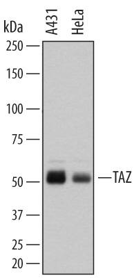 Western blot shows lysates of A431 human epithelial carcinoma cell line and HeLa human cervical epithelial carcinoma cell line. PVDF membrane was probed with 2 µg/mL of Mouse Anti-Human TAZ/WWTR1 Monoclonal Antibody (Catalog # MAB7210) followed by HRP-conjugated Anti-Mouse IgG Secondary Antibody (Catalog # HAF007). A specific band was detected for TAZ/WWTR1 at approximately 50 kDa (as indicated). This experiment was conducted under reducing conditions and using Immunoblot Buffer Group 1.