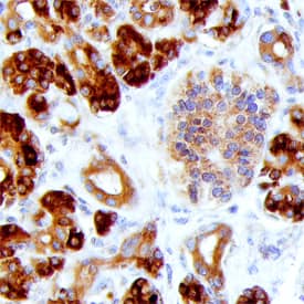 Reg1A was detected in immersion fixed paraffin-embedded sections of human pancreas using Rat Anti-Human Reg1A Monoclonal Antibody (Catalog # MAB49371) at 15 µg/mL overnight at 4 °C. Before incubation with the primary antibody, tissue was subjected to heat-induced epitope retrieval using Antigen Retrieval Reagent-Basic (Catalog # CTS013). Tissue was stained using the Anti-Rat HRP-DAB Cell & Tissue Staining Kit (brown; Catalog # CTS017) and counterstained with hematoxylin (blue). Specific staining was localized to exocrine cells. View our protocol for Chromogenic IHC Staining of Paraffin-embedded Tissue Sections.