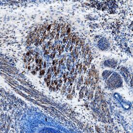 TGF-beta 2 was detected in immersion fixed frozen sections of mouse embryo (15 d.p.c.) using Rat Anti-Mouse TGF-beta 2 Monoclonal Antibody (Catalog # MAB73461) at 25 µg/mL overnight at 4 °C. Tissue was stained using the Anti-Rat HRP-DAB Cell & Tissue Staining Kit (brown; Catalog # CTS017) and counterstained with hematoxylin (blue). Specific staining was localized to neuronal processes. View our protocol for Chromogenic IHC Staining of Frozen Tissue Sections.