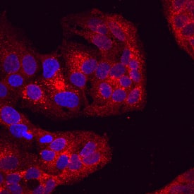 Attractin was detected in immersion fixed HepG2 human hepatocellular carcinoma cell line using Mouse Anti-Human Attractin Monoclonal Antibody (Catalog # MAB7238) at 10 µg/mL for 3 hours at room temperature. Cells were stained using the Northern-Lights™ 557-conjugated Anti-Mouse IgG Secondary Antibody (red; Catalog # NL007) and counterstained with DAPI (blue). View our protocol for Fluorescent ICC Staining of Cells on Coverslips.
