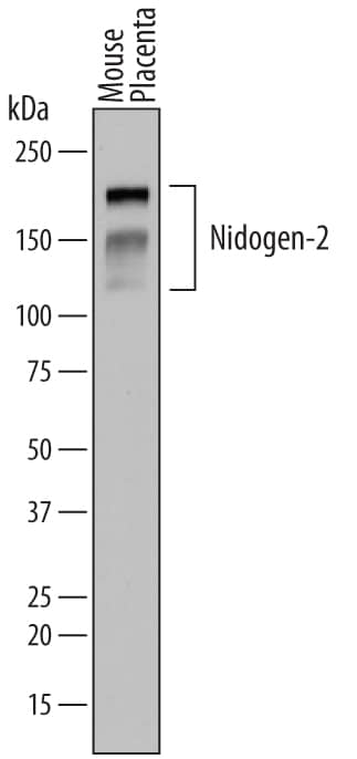 Western blot shows lysates of mouse placenta tissue. PVDF membrane was probed with 2 µg/mL of Rat Anti-Mouse Nidogen-2 Monoclonal Antibody (Catalog # MAB6760) followed by HRP-conjugated Anti-Rat IgG Secondary Antibody (Catalog # HAF005). Specific bands were detected for Nidogen-2 at approximately 120-200 kDa (as indicated). This experiment was conducted under reducing conditions and using Immunoblot Buffer Group 1.