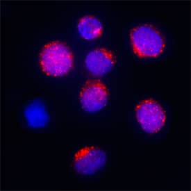GRK5 was detected in immersion fixed BJAB human Burkitt's lymphoma cell line using Mouse Anti-Human GRK5 Monoclonal Antibody (Catalog # MAB4539) at 25 µg/mL for 3 hours at room temperature. Cells were stained using the NorthernLights™ 557-conjugated Anti-Mouse IgG Secondary Antibody (red; Catalog # NL007) and counterstained with DAPI (blue). Specific staining was localized to cytoplasm. View our protocol for Fluorescent ICC Staining of Non-adherent Cells.