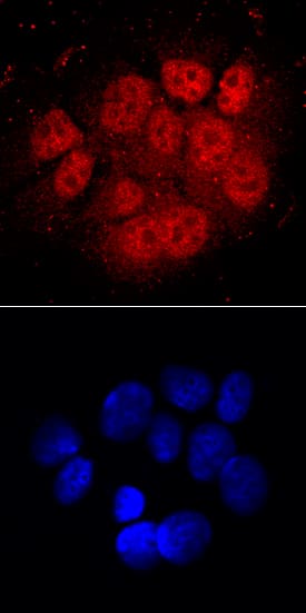 ARNT/HIF-1 beta  was detected in immersion fixed MCF-7 human breast cancer cell line using Mouse Anti-Human ARNT/HIF-1 beta  Monoclonal Antibody (Catalog # MAB5630) at 10 µg/mL for 3 hours at room temperature. Cells were stained using the NorthernLights™ 557-conjugated Anti-Mouse IgG Secondary Antibody (red, upper panel; Catalog # NL007) and counterstained with DAPI (blue, lower panel). Specific staining was localized to nuclei and cytoplasm. View our protocol for Fluorescent ICC Staining of Cells on Coverslips.