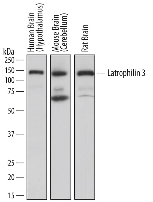 Western blot shows lysates of human brain (hypothalamus) tissue, mouse brain (cerebellum) tissue, and rat brain tissue. PVDF membrane was probed with 2 µg/mL of Mouse Anti-Human Latrophilin 3/LPHN3 Monoclonal Antibody (Catalog # MAB5916) followed by HRP-conjugated Anti-Mouse IgG Secondary Antibody (Catalog # HAF018). A specific band was detected for Latrophilin 3/LPHN3 at approximately 140 kDa (as indicated). This experiment was conducted under reducing conditions and using Immunoblot Buffer Group 1.