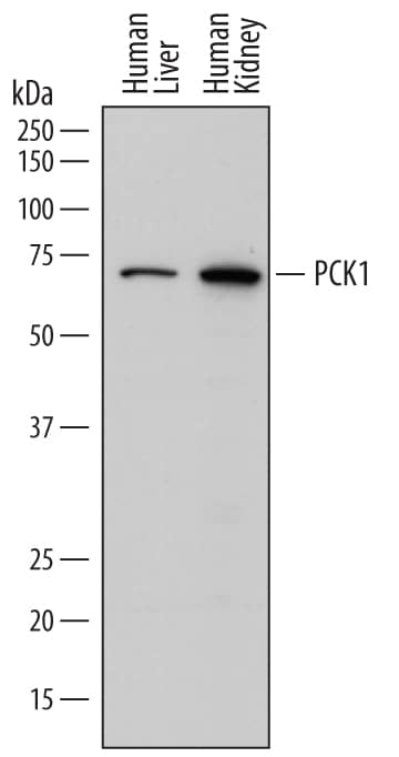 Western blot shows lysates of human liver tissue and human kidney tissue. PVDF membrane was probed with 1 µg/mL of Mouse Anti-Human PCK1 Monoclonal Antibody (Catalog # MAB7316) followed by HRP-conjugated Anti-Mouse IgG Secondary Antibody (Catalog # HAF018). A specific band was detected for PCK1 at approximately 68 kDa (as indicated). This experiment was conducted under reducing conditions and using Immunoblot Buffer Group 1.