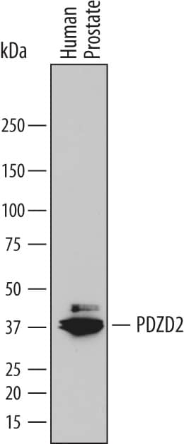 Western Blot PDZD2/PDZK3 Antibody (787924)