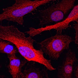 Glutathione S-Transferase pi 1/GSTP1 was detected in immersion fixed HeLa human cervical epithelial carcinoma cell line using Mouse Anti-Human Glutathione S-Transferase pi 1/GSTP1 Monoclonal Antibody (Catalog # MAB6455) at 10 µg/mL for 3 hours at room temperature. Cells were stained using the NorthernLights™ 557-conjugated Anti-Mouse IgG Secondary Antibody (red; Catalog # NL007) and counterstained with DAPI (blue). Specific staining was localized to cytoplasm. View our protocol for Fluorescent ICC Staining of Cells on Coverslips.