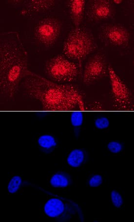 Immunocytochemistry PDZD2/PDZK3 Antibody (787924)