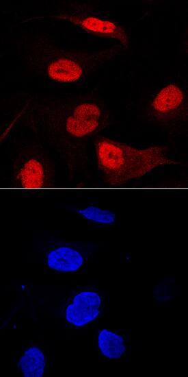  beta -TrCP1/BTRC was detected in immersion fixed A172 human glioblastoma cell line using Mouse Anti-Human  beta -TrCP1/BTRC Monoclonal Antibody (Catalog # MAB7675) at 10 µg/mL for 3 hours at room temperature. Cells were stained using the NorthernLights™ 557-conjugated Anti-Mouse IgG Secondary Antibody (red, upper panel; Catalog # NL007) and counterstained with DAPI (blue, lower panel). Specific staining was localized to nuclei. View our protocol for Fluorescent ICC Staining of Cells on Coverslips.