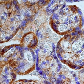 Perilipin-3 was detected in immersion fixed paraffin-embedded sections of human placenta using Mouse Anti-Human Perilipin-3 Monoclonal Antibody (Catalog # MAB76641) at 25 µg/mL overnight at 4 °C. Tissue was stained using the Anti-Mouse HRP-DAB Cell & Tissue Staining Kit (brown; Catalog # CTS002) and counterstained with hematoxylin (blue). Specific staining was localized to cytoplasm of syncytiotrophoblast cells. View our protocol for Chromogenic IHC Staining of Paraffin-embedded Tissue Sections.