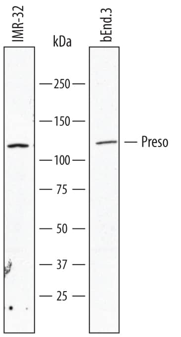 Western Blot Preso/FRMPD4 Antibody (809408) [Unconjugated]