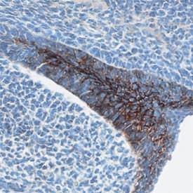 Immunohistochemistry Desmocollin-3 Antibody (765129)