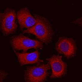 Semaphorin 3C was detected in immersion fixed MCF-7 human breast cancer cell line using Mouse Anti-Human Semaphorin 3C Monoclonal Antibody (Catalog # MAB5570) at 10 µg/mL for 3 hours at room temperature. Cells were stained using the NorthernLights™ 557-conjugated Anti-Mouse IgG Secondary Antibody (red; Catalog # NL007) and counterstained with DAPI (blue). View our protocol for Fluorescent ICC Staining of Cells on Coverslips.