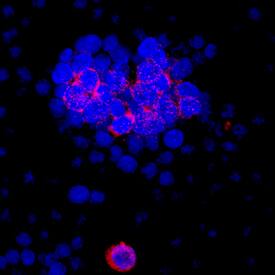 IL-17F was detected in immersion fixed Th17-differentiated rat splenocytes using Mouse Anti-Rat IL-17F Monoclonal Antibody (Catalog # MAB4437) at 10 µg/mL for 3 hours at room temperature. Cells were stained using the NorthernLights™ 557-conjugated Anti-Mouse IgG Secondary Antibody (red; Catalog # NL007) and counterstained with DAPI (blue). Specific staining was localized to cell surfaces and cytoplasm. View our protocol for Fluorescent ICC Staining of Non-adherent Cells.