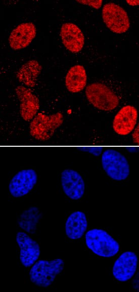 Immunocytochemistry LEDGF Antibody (762815) [Unconjugated]
