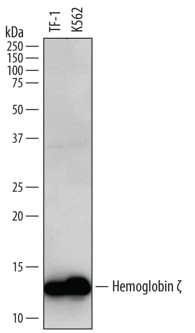 Western Blot Hemoglobin zeta Antibody (778633)