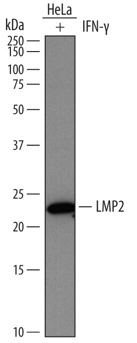 Western Blot LMP2/PSMB9 Antibody (792520)